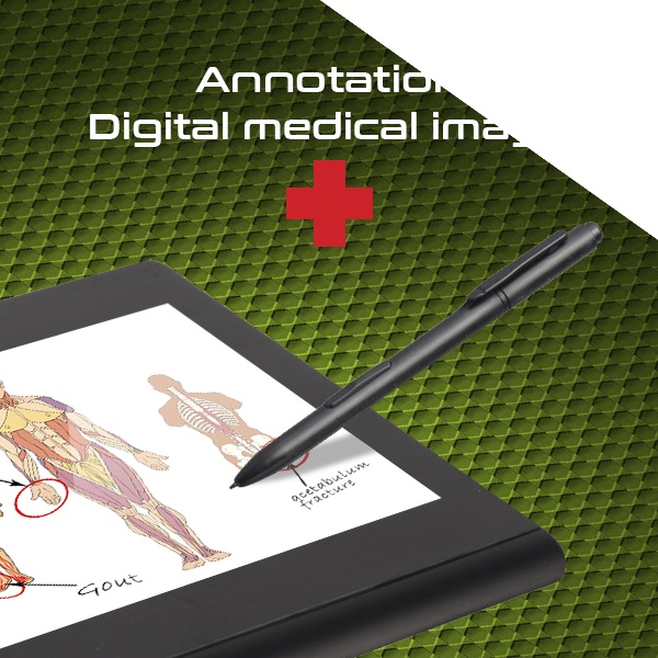 Medical image annotation